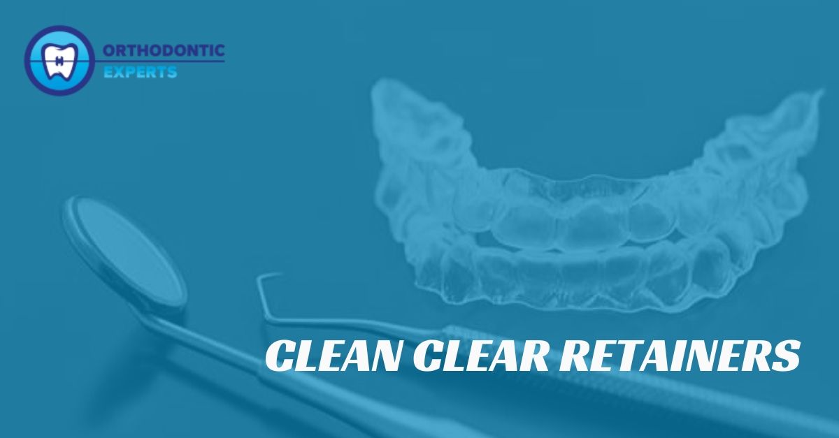 How to Clean Clear Retainers the Safe and Natural Way