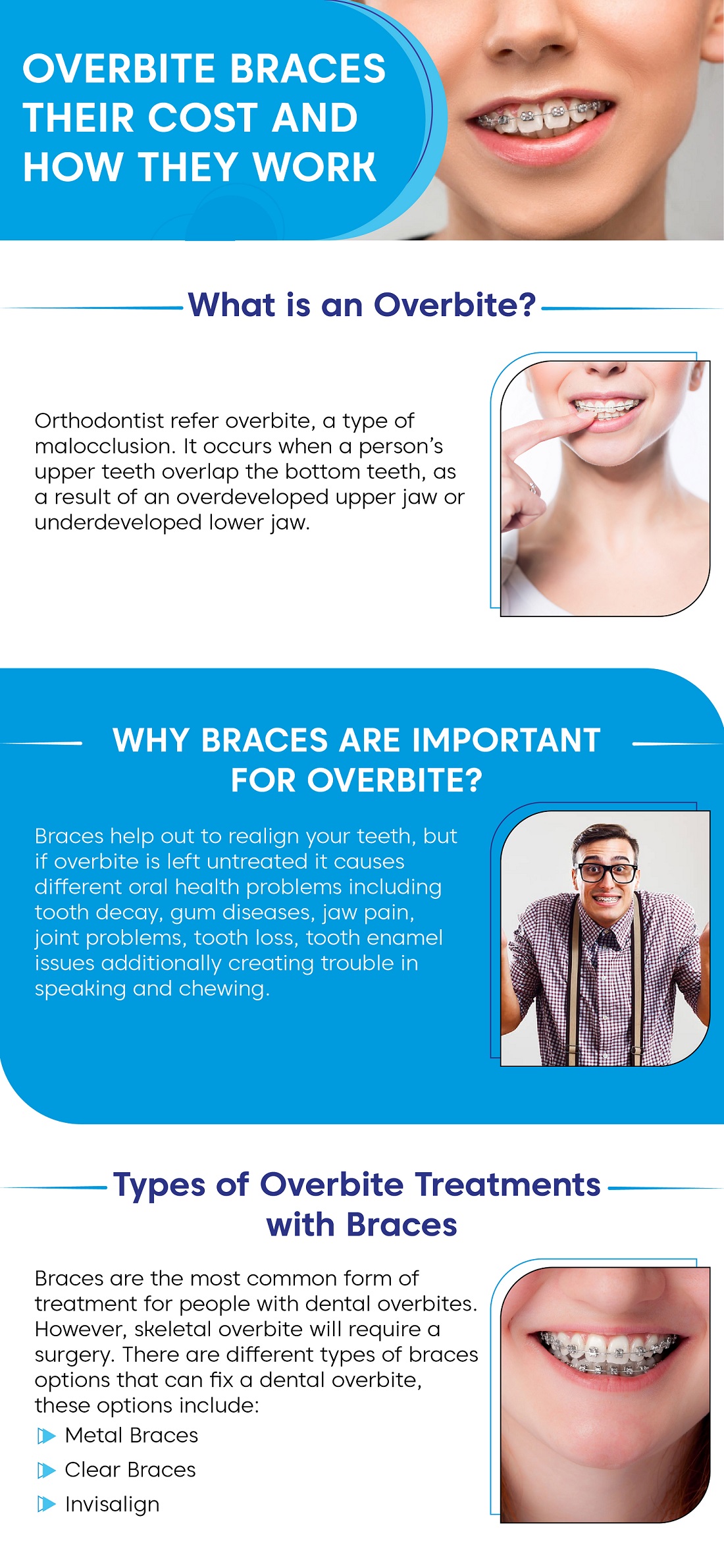 Overbite Braces Their Cost And How They Work Orthodontic Experts