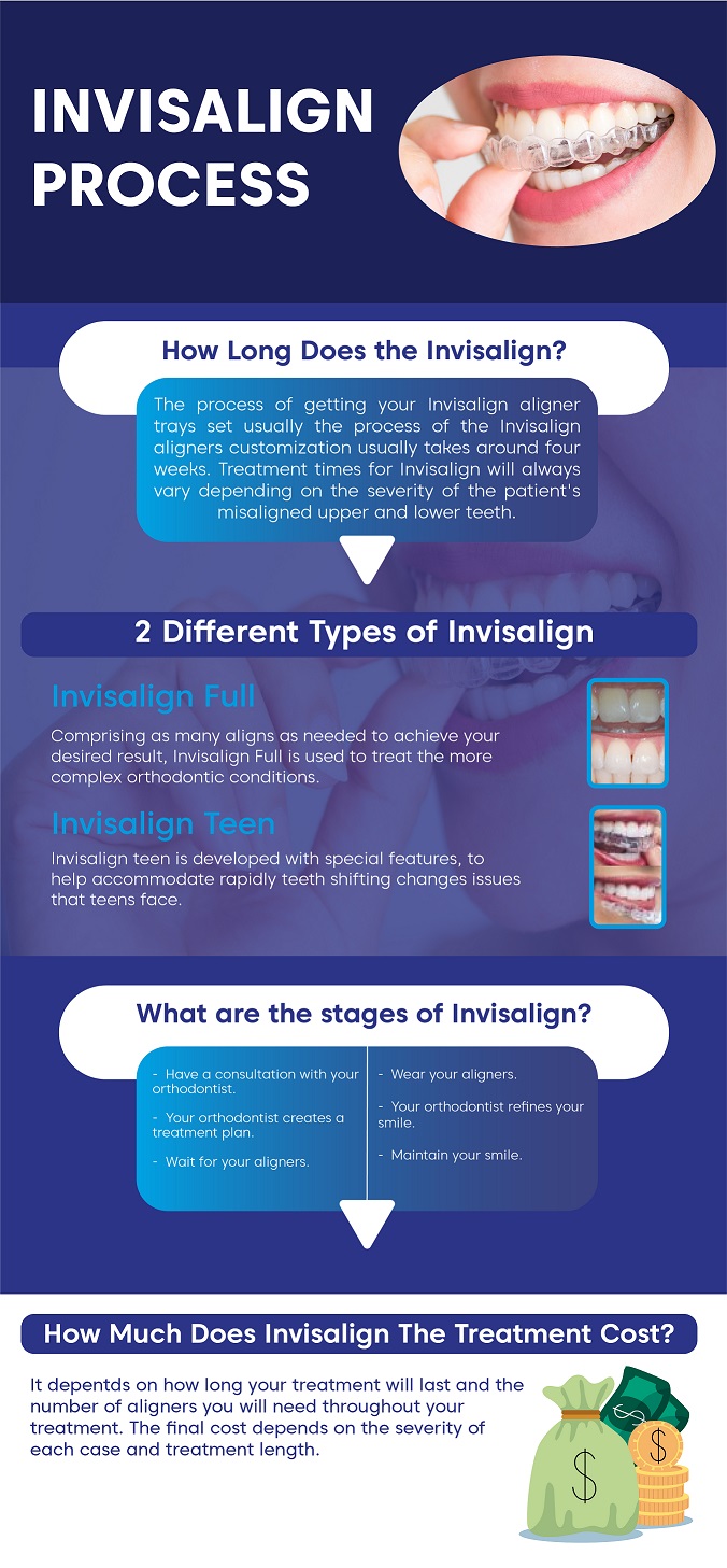 How Long Does Invisalign Take | Invisalign Process