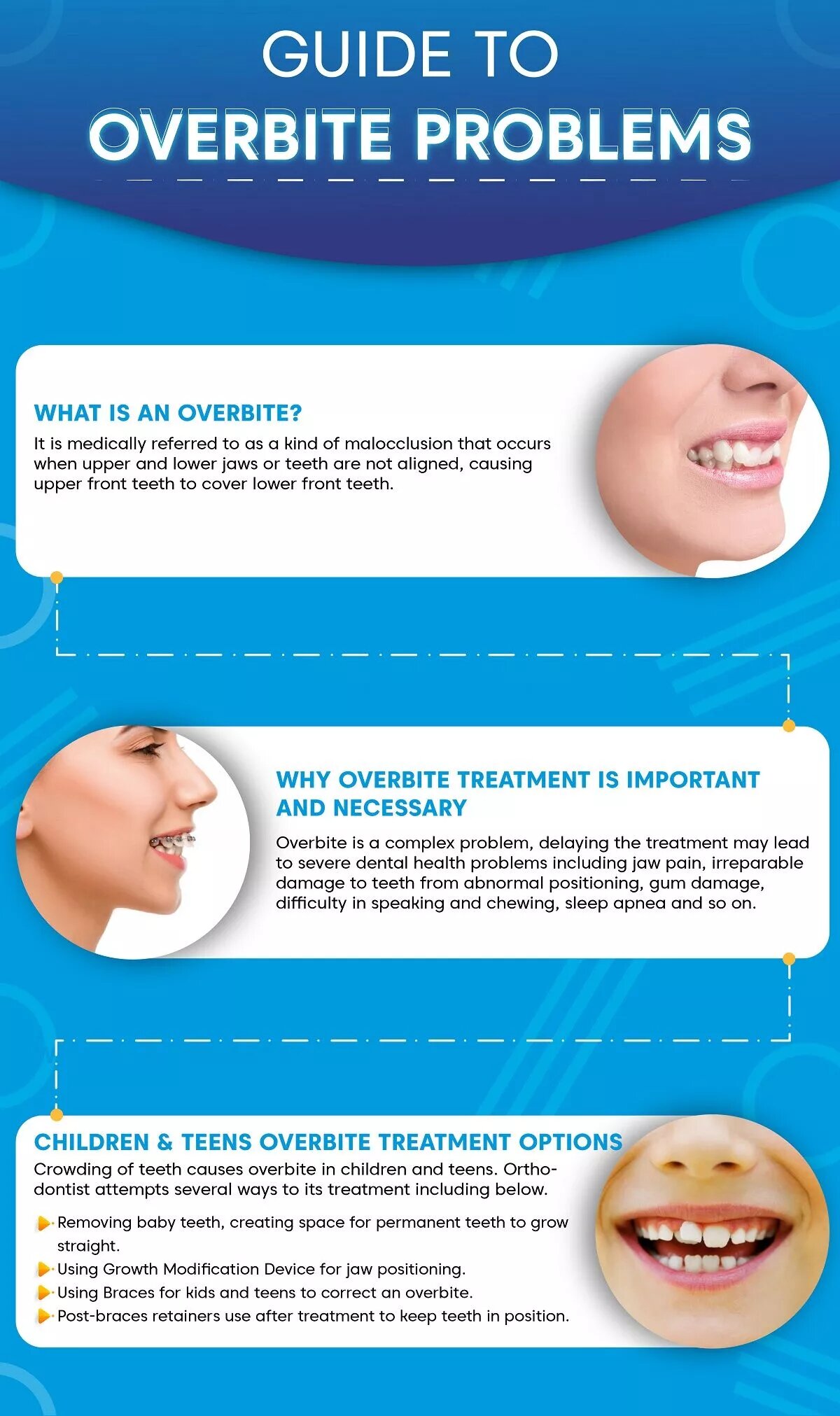 A Guide to Overbite Problems: Causes and Treatment Methods