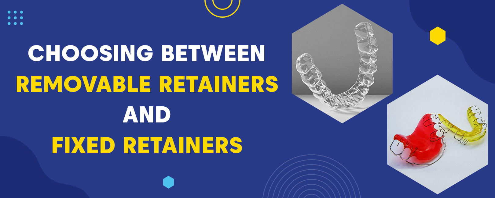 Removable Vs. Fixed Retainers: Which Is Right For You?